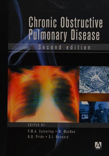 Cover image for Chronic obstructive pulmonary disease