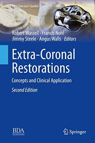 Cover image for Extra-Coronal Restorations