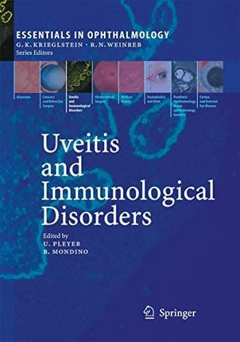 Cover image for Uveitis and Immunological Disorders