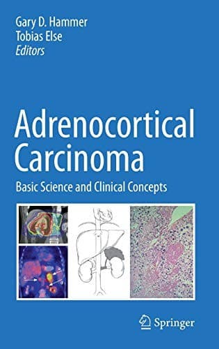 Cover image for Adrenocortical Carcinoma