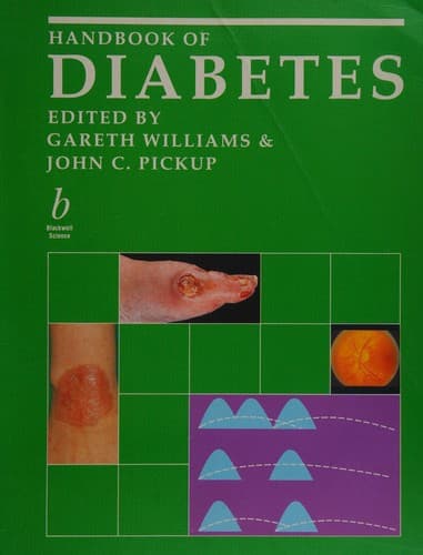Cover image for Handbook of Diabetes