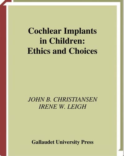 Cover image for Cochlear Implants in Children