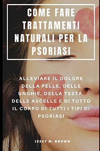 COME FARE TRATTAMENTI NATURALI PER LA PSORIASI