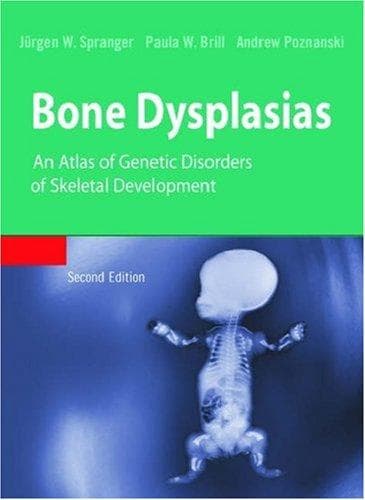 Cover image for Bone Dysplasias
