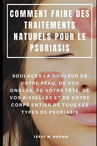 COMMENT FAIRE DES TRAITEMENTS NATURELS POUR LE PSORIASIS