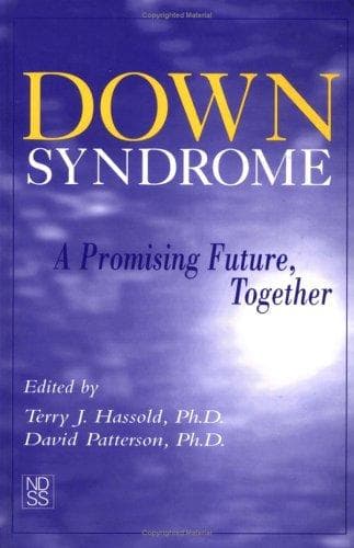 Cover image for Down Syndrome