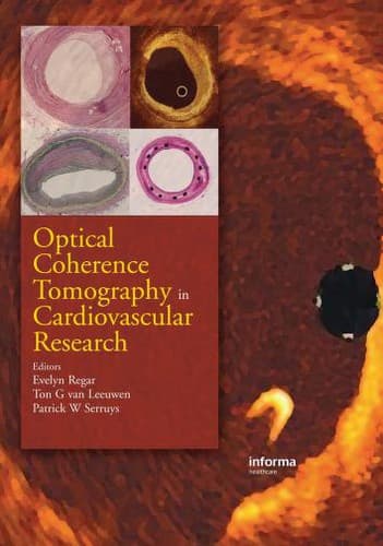 Cover image for Optical Coherence Tomography in Cardiovascular Research