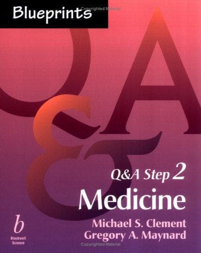 Cover image for Blueprints Q&A Step 2