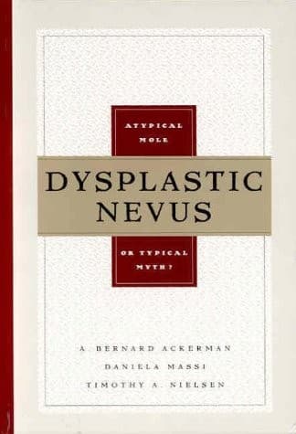 Cover image for Dysplastic nevus