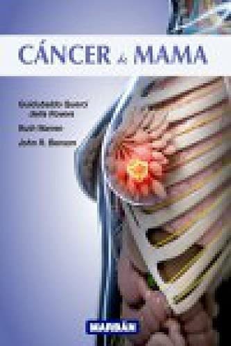 Cover image for Cáncer de mama