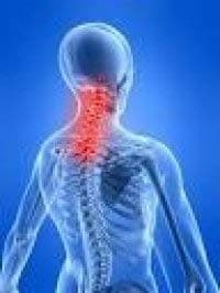 Cover image for Neck pain