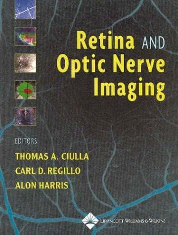 Cover image for Retina and Optic Nerve Imaging