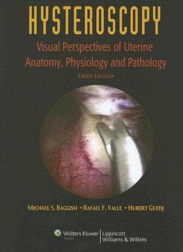 Cover image for Hysteroscopy