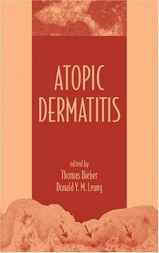 Cover image for Atopic Dermatitis