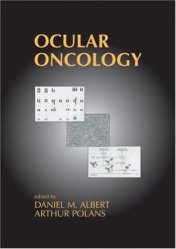 Cover image for Ocular Oncology