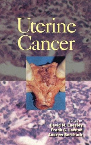 Cover image for Uterine Cancer