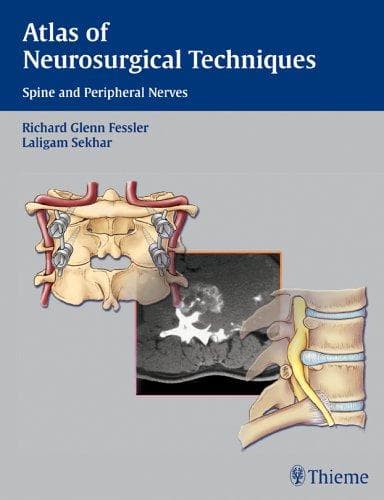 Cover image for Atlas of Neurosurgical Techniques