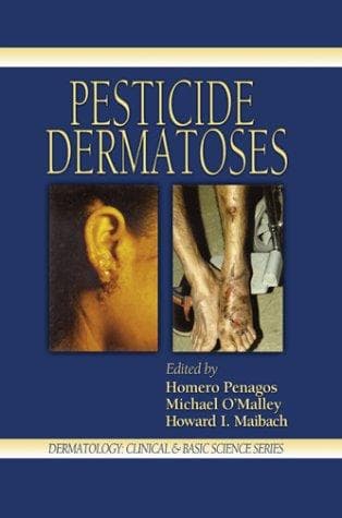 Cover image for Pesticide dermatosis