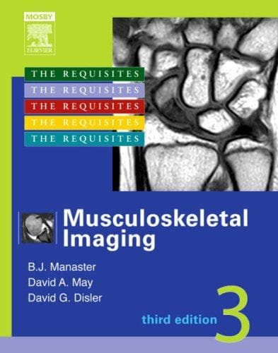 Cover image for Musculoskeletal Imaging