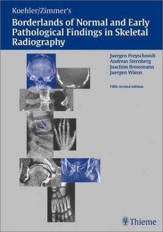 Freyschmidt's "Koehler/Zimmer" borderlands of normal and early pathologic findings in skeletal radiography