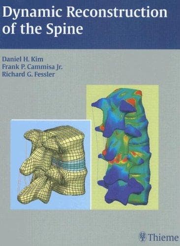 Cover image for Dynamic Reconstruction of the Spine