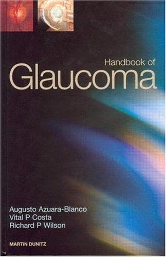 Cover image for Handbook of Glaucoma