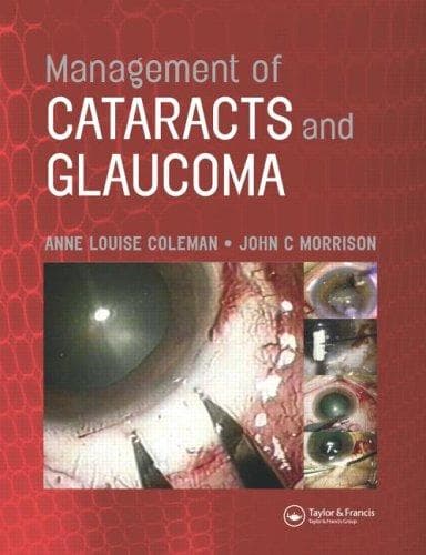 Cover image for Management of Cataracts and Glaucoma