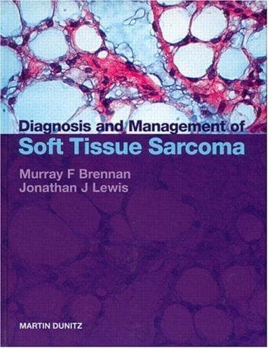 Cover image for Diagnosis and Management of Sarcoma