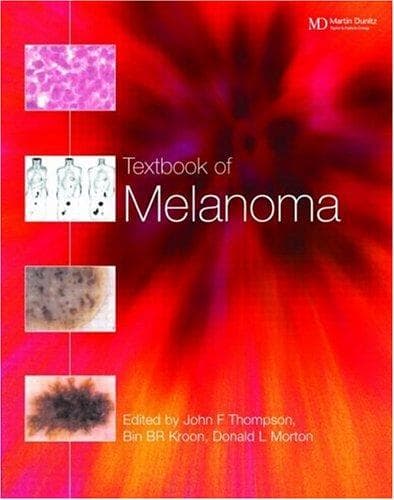 Cover image for Textbook of Melanoma