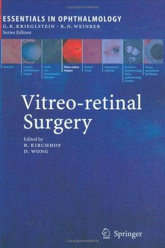Cover image for Vitreo-retinal Surgery