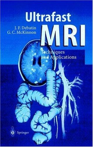 Cover image for Ultrafast Mri