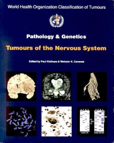 Cover image for World Health Organization Classification of Tumours: Pathology and Genetics