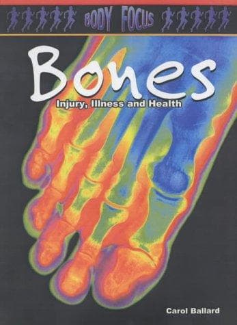 Cover image for Bones (Body Focus)