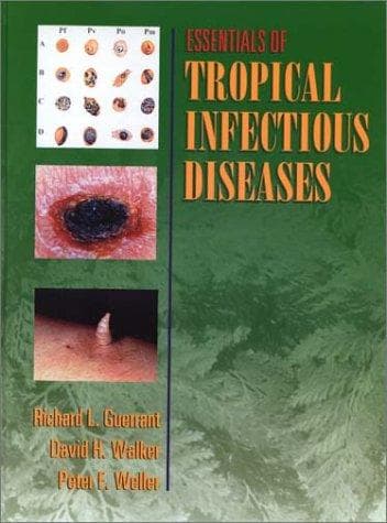 Cover image for Essentials of Tropical Infectious Disease