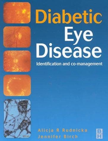 Diabetic eye disease