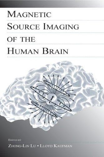 Cover image for Magnetic Source Imaging of the Human Brain