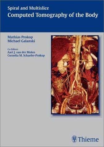 Cover image for Spiral and Multislice Computed Tomography of the Body