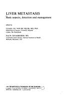 Cover image for Liver Metastasis