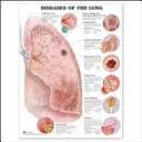 Cover image for Diseases of the Lung Anatomical Chart