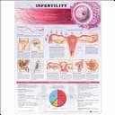 Cover image for Infertility Anatomical Chart