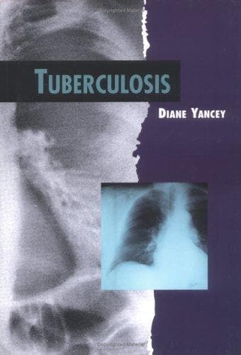 Cover image for Tuberculosis (Twenty-First Century Medical Library)