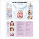 Cover image for Thyroid Disorders Anatomical Chart