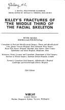 Cover image for Killey's fractures of the middle third of the facial skeleton.