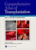 Cover image for Comprehensive Atlas of Transplantation