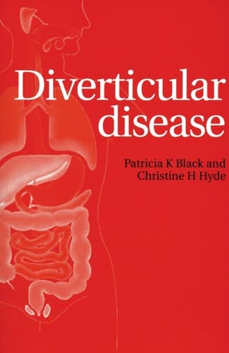 Cover image for Diverticular disease